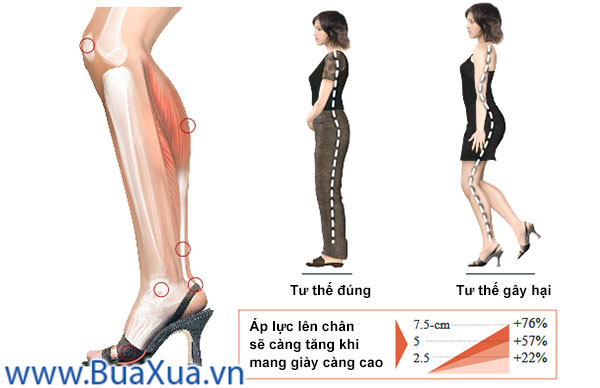 Tác hại khi mang giày cao gót thường xuyên
