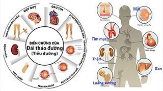 Ngày Đái tháo đường Thế giới